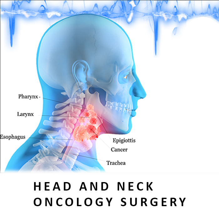 Head and neck Oncology Surgery in Ahmedabad, Gujarat