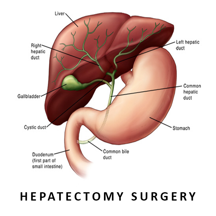 Hepatectomy Surgery in Ahmedabad, Gujarat