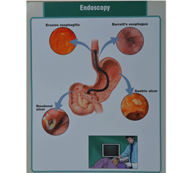 Endoscopy Endoscopy