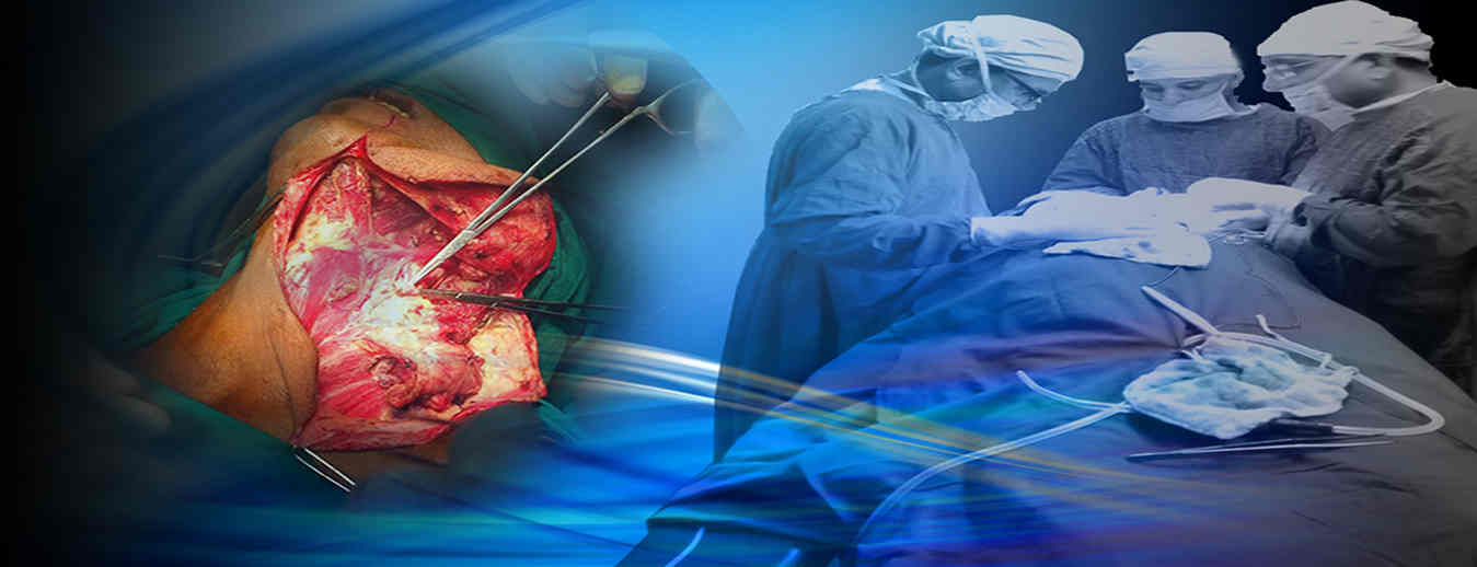 Success Result Cancer Surgeon in Ahmedabad